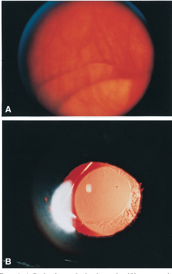 Figure 3 from Surgical management and of