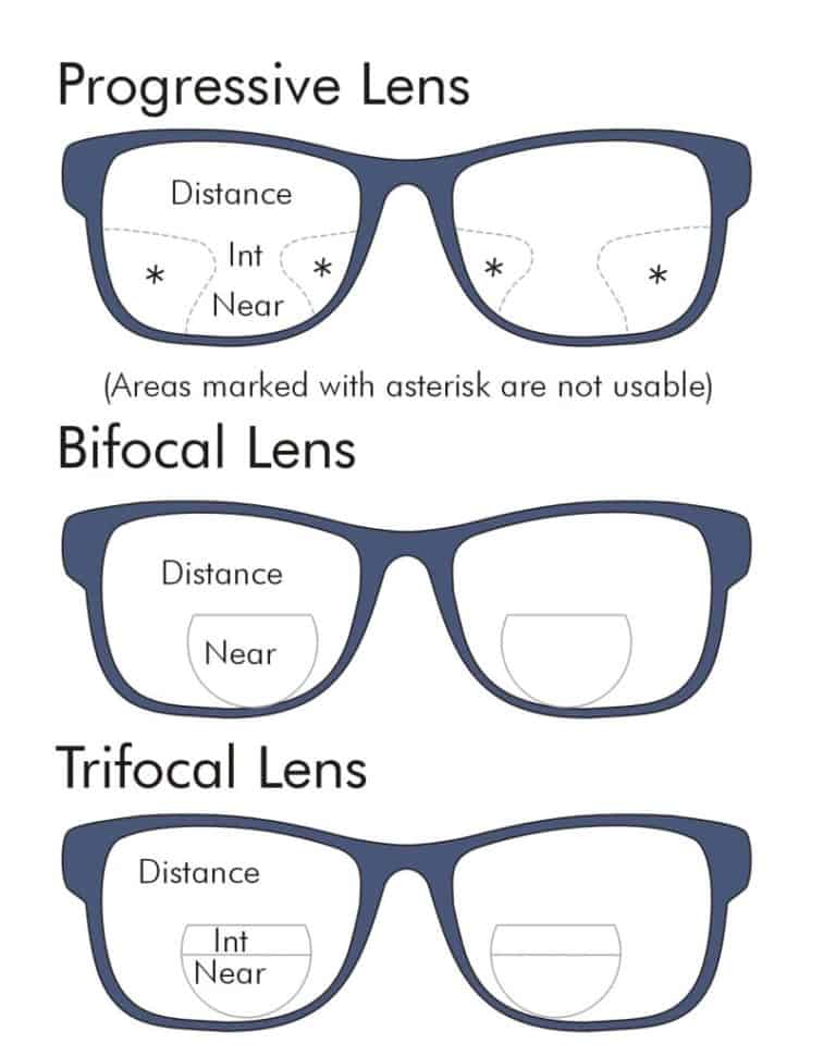 Guide for selecting Glasses and Contact lenses (Myopia