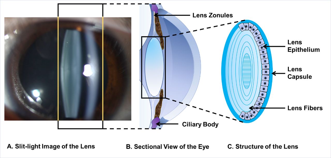 Structure of the lens and its associations with the visual