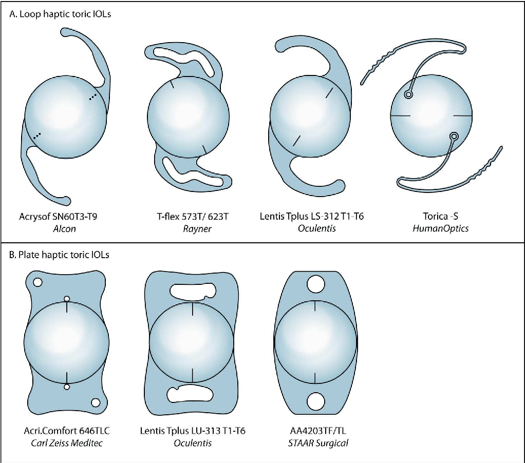 Figure 1 from Toric Intraocular lenses in cataract surgery