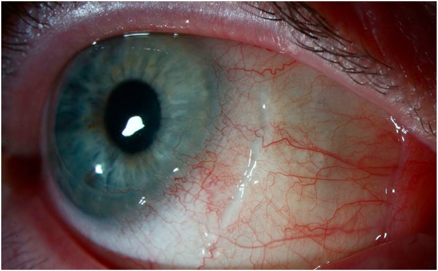 Anatomical and physiological considerations in scleral