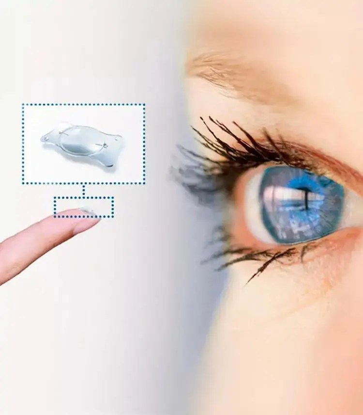 Lens Surgery with EuroEyes Specialist and Test Winner