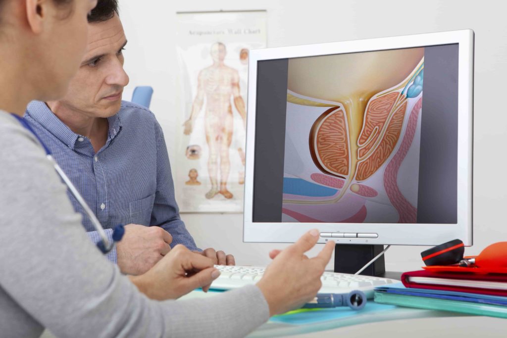 Prostate Artery Embolization Abroad Poland EuroTreatMed