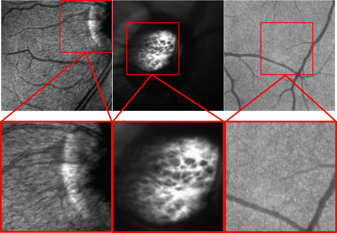 SPECTRALIS High Magnification Module Receives CE Marking