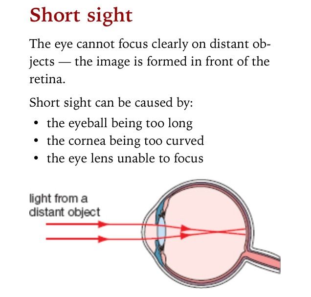 Short sight. Light wave. Focus light. The retina