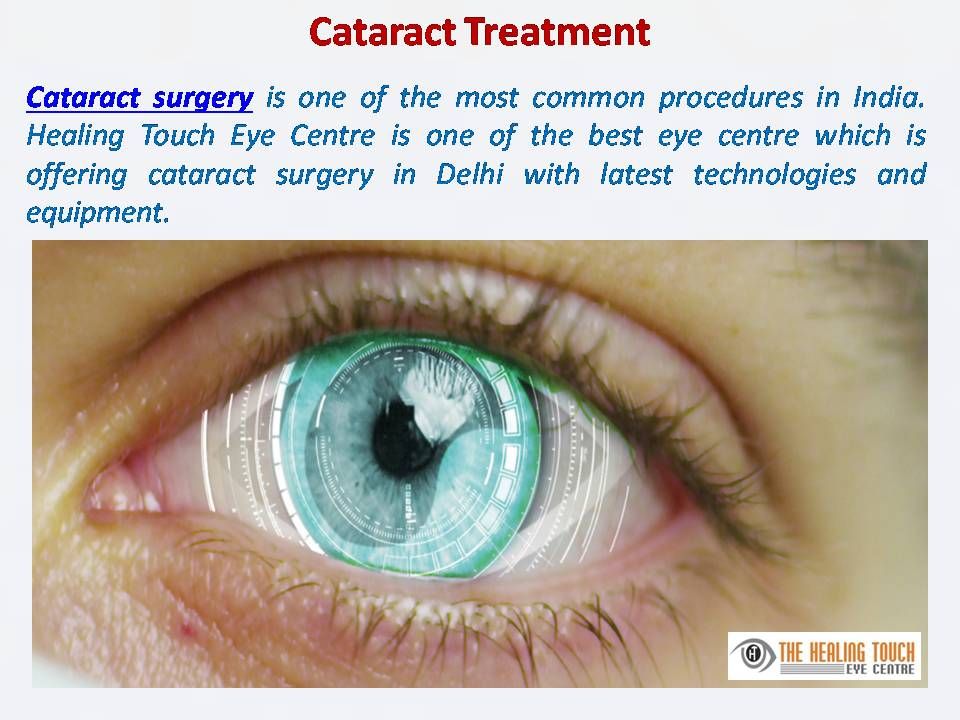 How Long Does Cataract Surgery Last