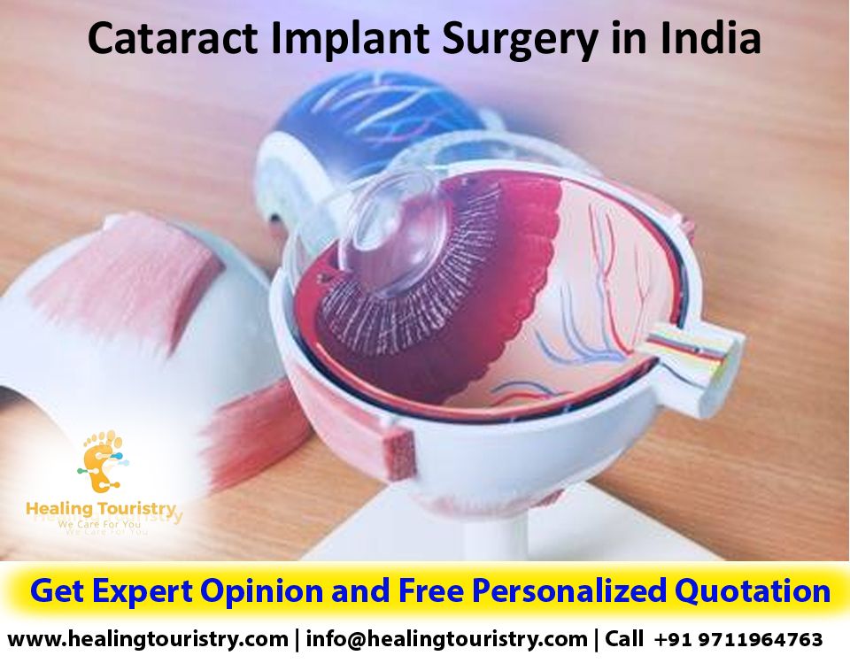 Cataract Implant Surgery in India in 2020 Cataract