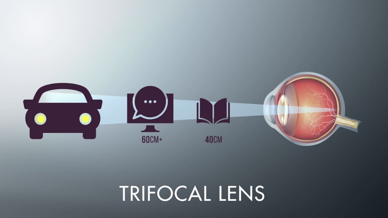 What Are My Lens Options for Cataract Surgery? YouTube