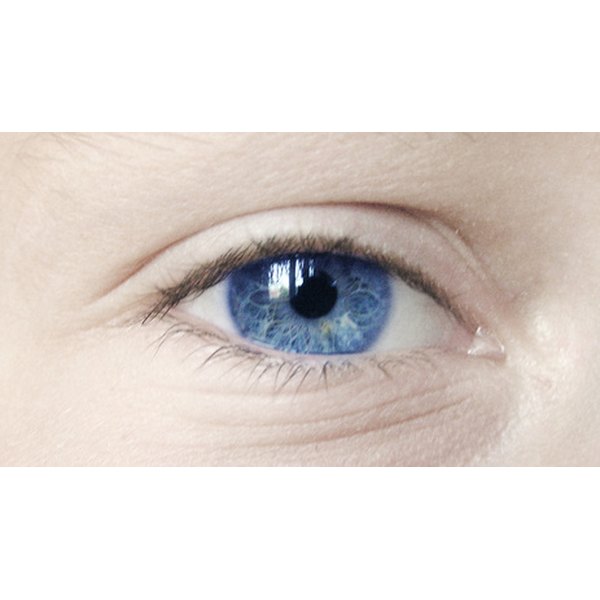 What Are the Causes of Film on Eye? Healthfully