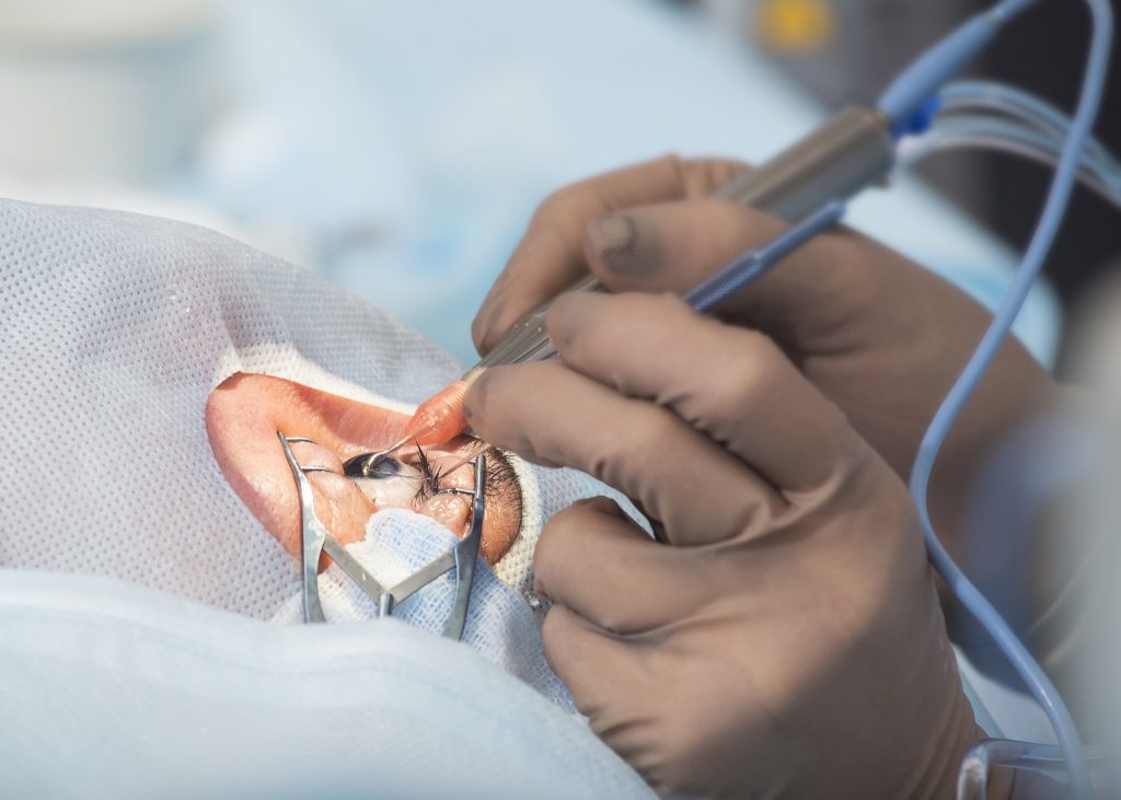 An IOL to change the cataract surgery paradigm? Insight