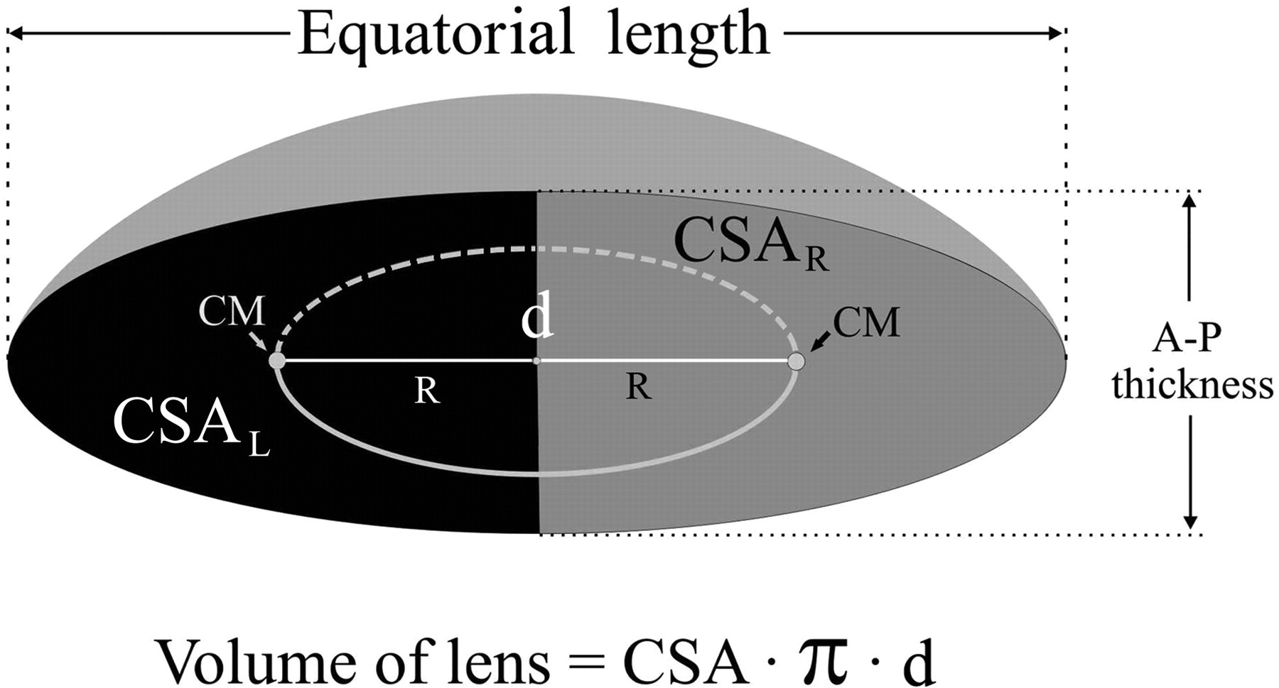 Volume change of the ocular lens during