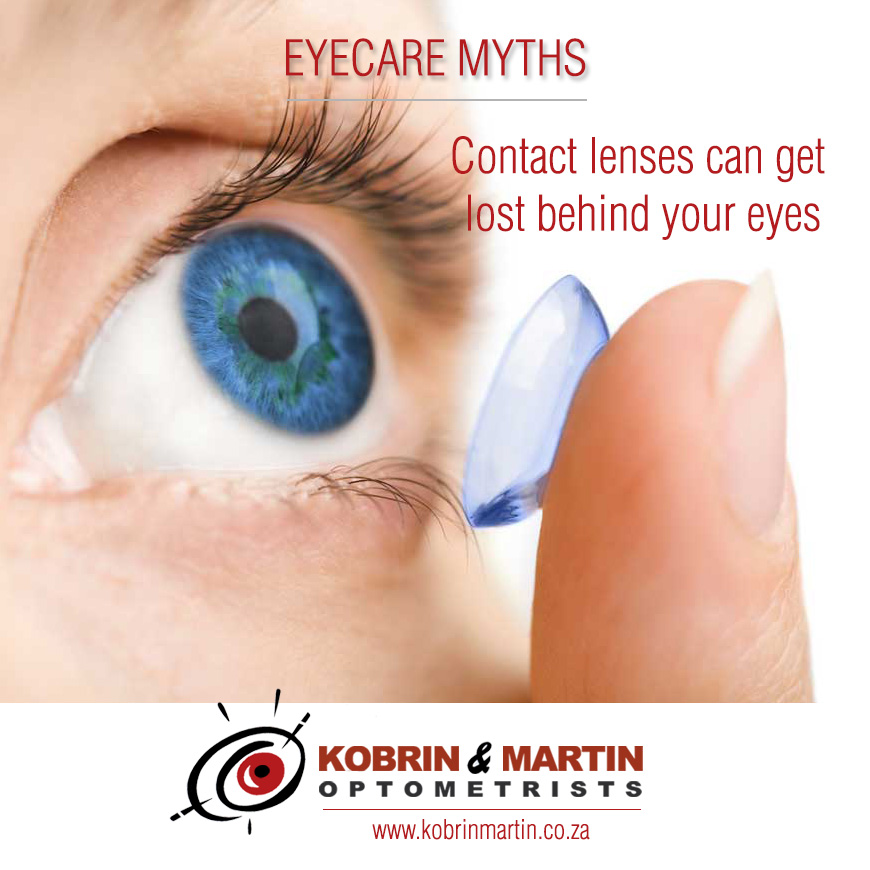 Myth 2 Contact lenses can get lost behind your eyes