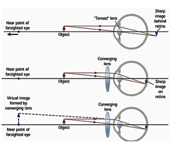 The human eye