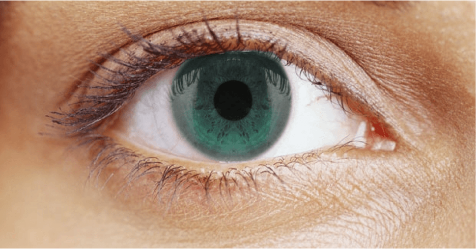 Lens Replacement Surgery Laser Eye Surgery Hub