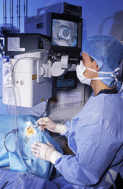 Laser eye surgery Stock Image M570/0152 Science