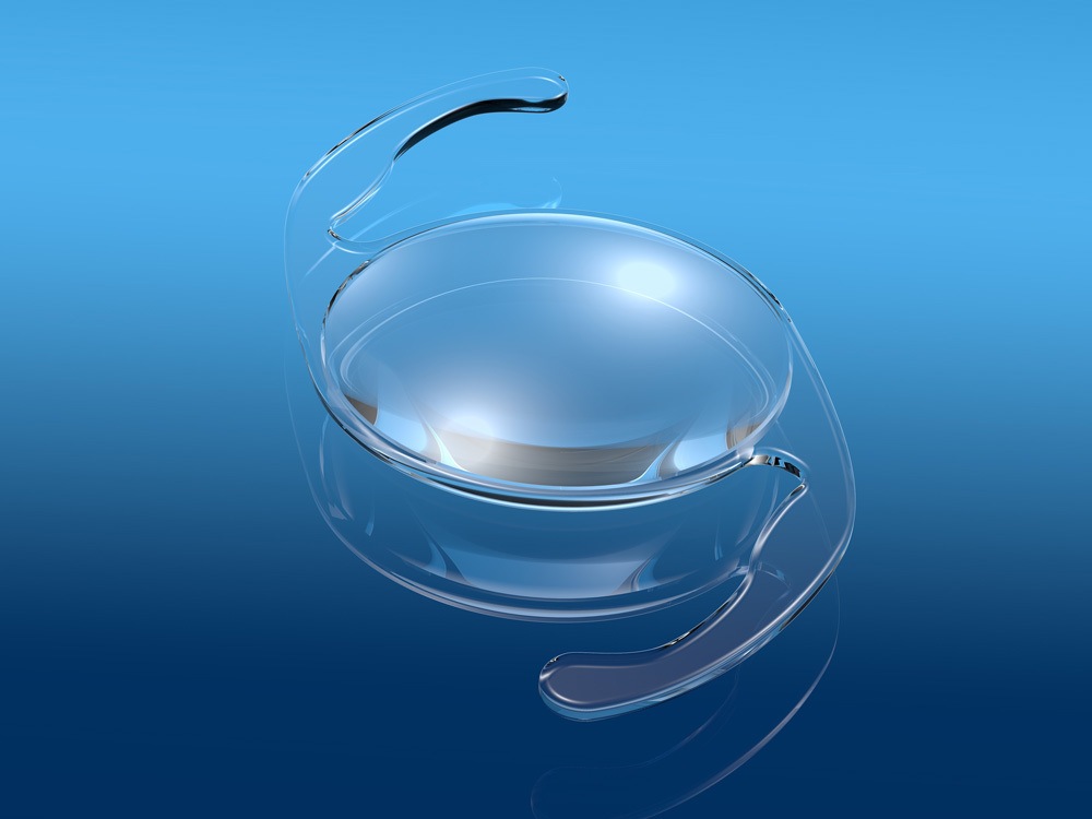 Choosing the Right Intraocular Lens for Cataract Surgery