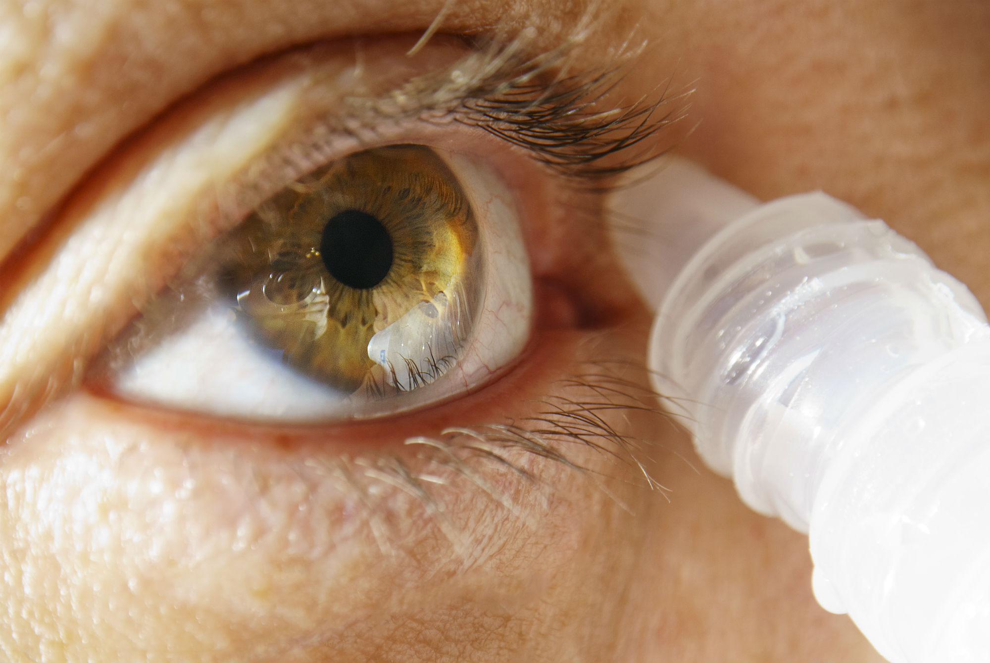 Woman had no idea she had 27 contact lenses stuck to her eye