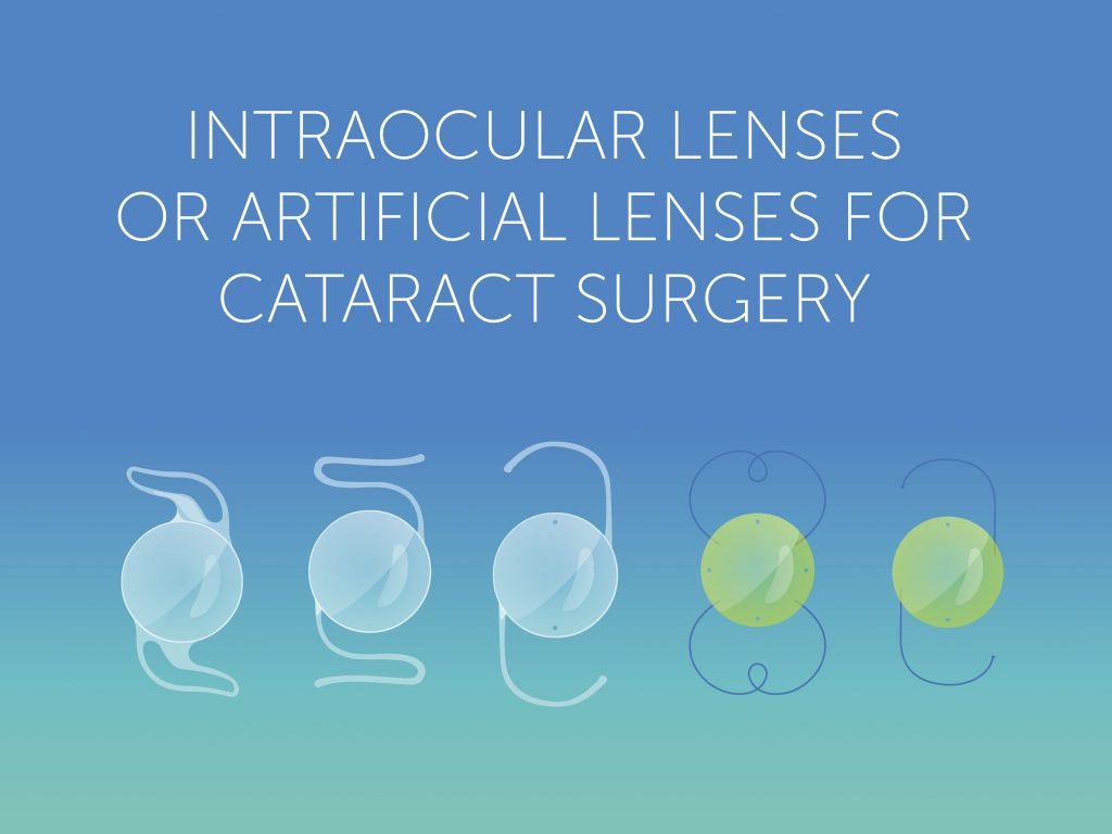 Advanced Technology Cataract Implant Lenses Pocatello