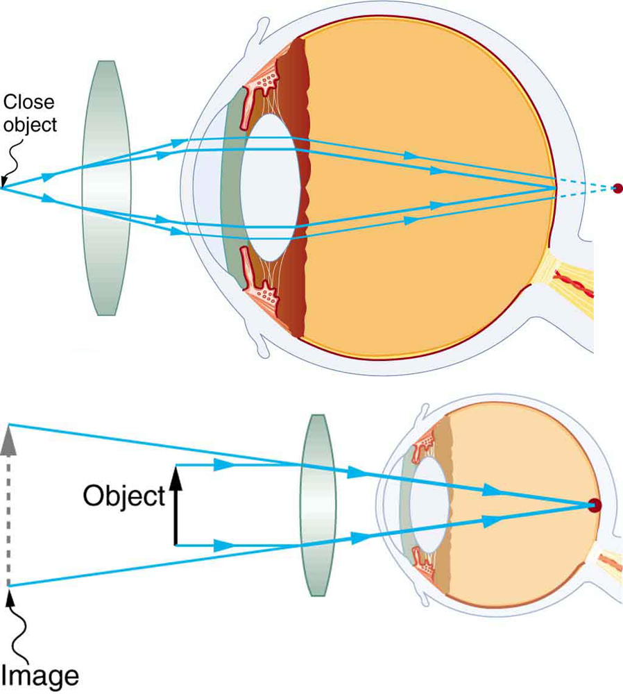 26.2 Vision Correction College Physics OpenStax