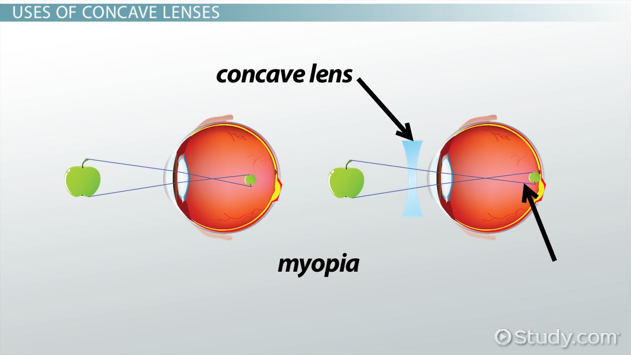 Concave Lens Definition Uses Video Lesson