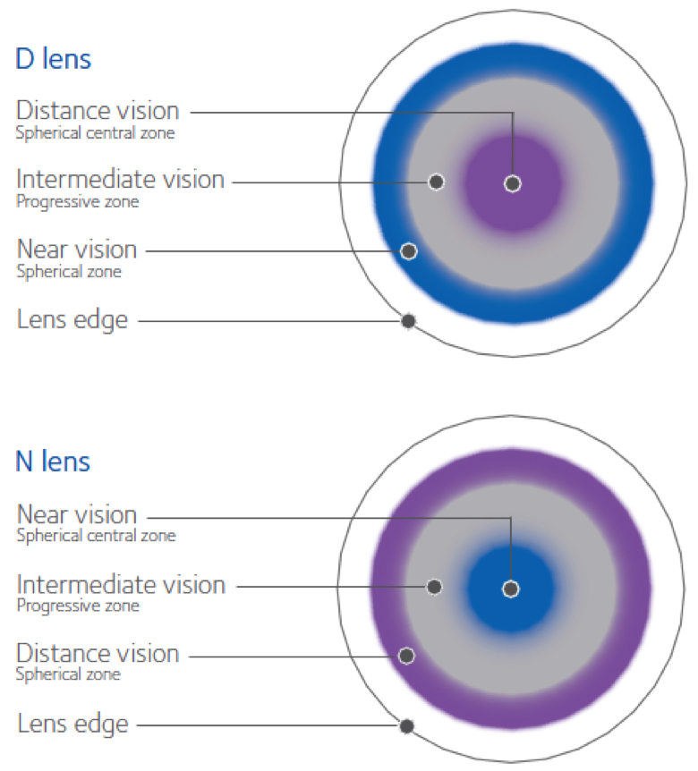 Multifocal Lenses TE Koza Optom