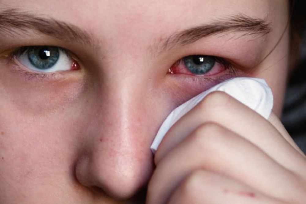 Different Types of Eye Infections Warning Signs The