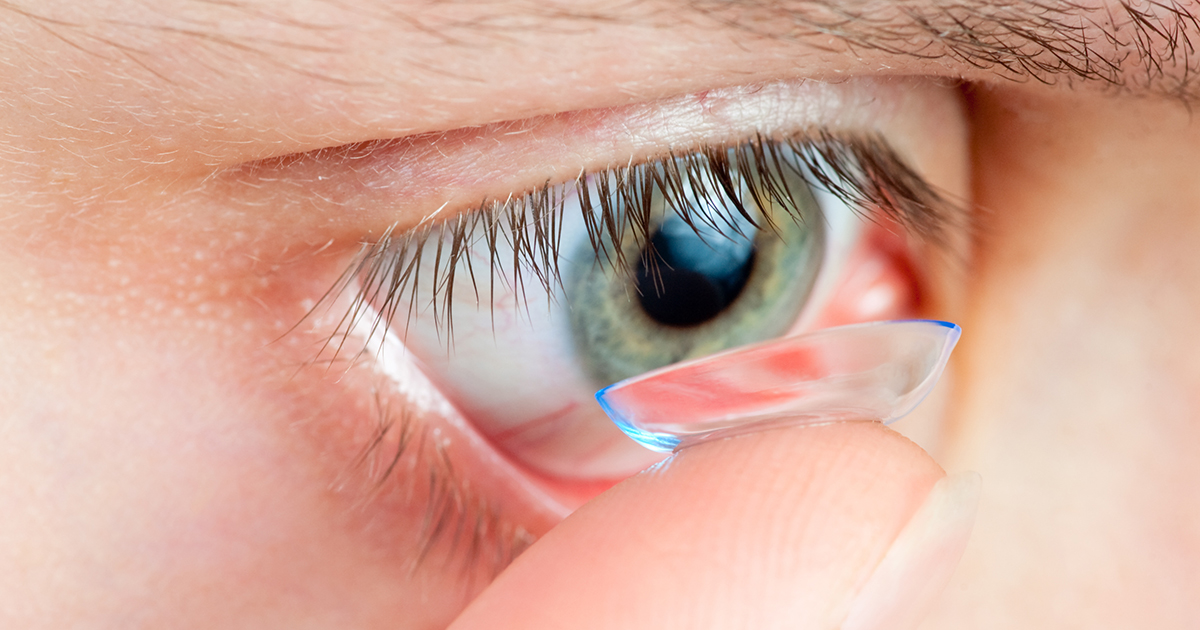 Fungal Keratitis or Keratomycosis Warning for Contact